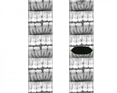 Sock Pair - Polyester - Dental X-Rays Black/White - CREW